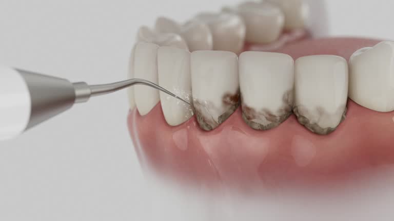 Trusted Tooth Extraction service in Kenly, NC - Dentist Open Now